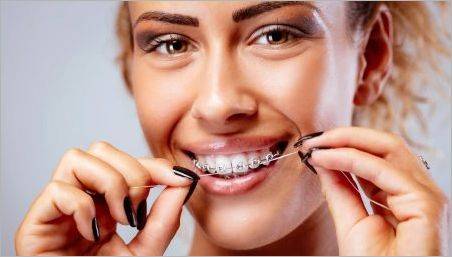 Cum să curățați și să vă îngrijiți dinții cu bretele?